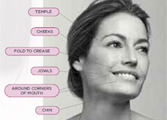 Go a Step Deeper, With Sculptra Injections
